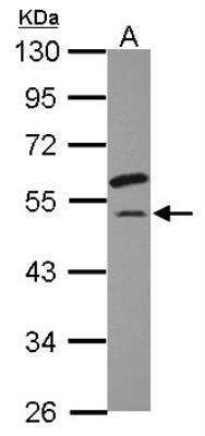 Western Blot: EIF2G Antibody [NBP2-16294]