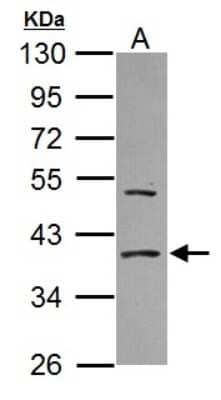 Western Blot: eIF2 alpha/EIF2S1 Antibody [NBP2-16295]