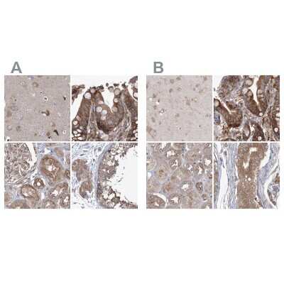 Immunohistochemistry-Paraffin: EIF3A Antibody [NBP1-84875]