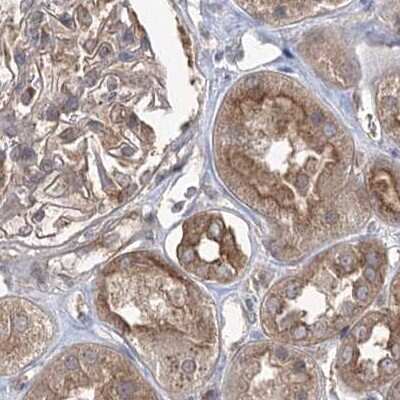 Immunohistochemistry-Paraffin: EIF3A Antibody [NBP1-84875]