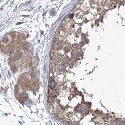 Immunohistochemistry-Paraffin: EIF3A Antibody [NBP1-84875]