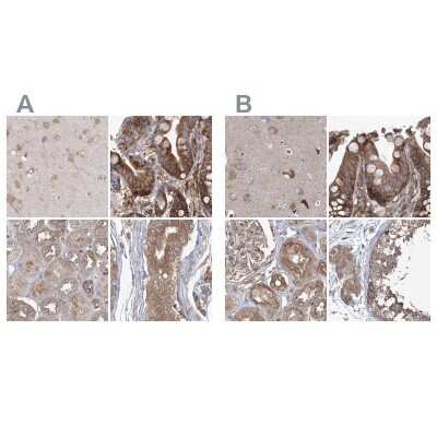 Immunohistochemistry-Paraffin: EIF3A Antibody [NBP1-84876]