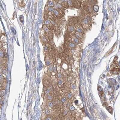 Immunohistochemistry-Paraffin: EIF3A Antibody [NBP1-84876]