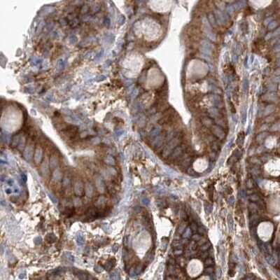 Immunohistochemistry-Paraffin: EIF3A Antibody [NBP1-84876]