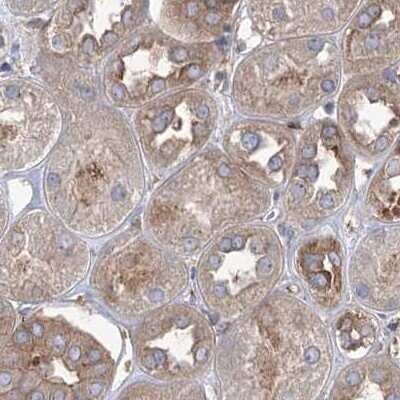 Immunohistochemistry-Paraffin: EIF3A Antibody [NBP1-84876]
