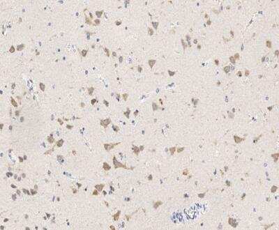 Immunohistochemistry-Paraffin: EIF3A Antibody [NBP3-12794]