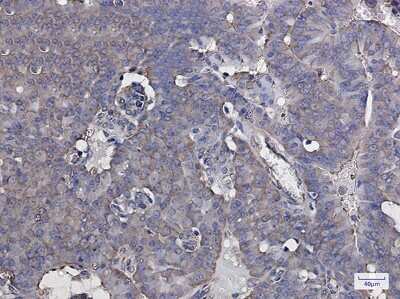 Immunohistochemistry-Paraffin: EIF3B Antibody (S09-2A9) [NBP3-15026]