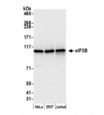 Western Blot: EIF3B Antibody [NB100-93302]