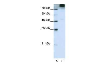 Western Blot: EIF3B Antibody [NBP2-87341]