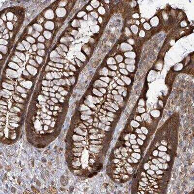 Immunohistochemistry-Paraffin: EIF3C Antibody [NBP2-46784]