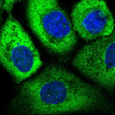 Immunocytochemistry/ Immunofluorescence: EIF3D Antibody [NBP2-58658]