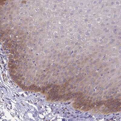 Immunohistochemistry-Paraffin: EIF3D Antibody [NBP2-38990]