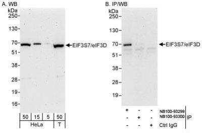 Western Blot: EIF3D Antibody [NB100-93299]