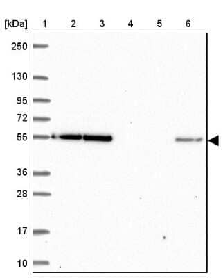 Western Blot: EIF3D Antibody [NBP2-38990]