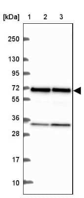 Western Blot: EIF3D Antibody [NBP2-39069]