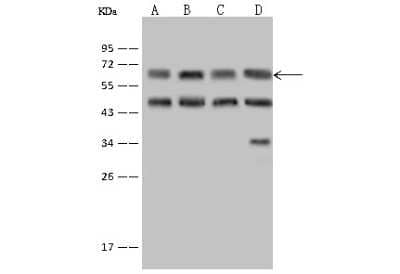 Western Blot: EIF3D Antibody [NBP2-97518]