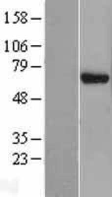 Western Blot: EIF3D Overexpression Lysate [NBL1-10191]