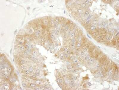 Immunohistochemistry-Paraffin: EIF3F Antibody [NBP1-50037]