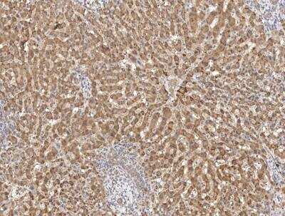 Immunohistochemistry: EIF3F Antibody [NBP3-12558]