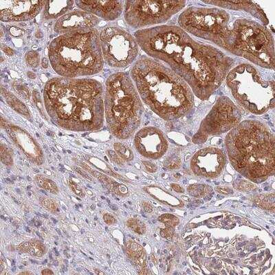 Immunohistochemistry-Paraffin: EIF3F Antibody [NBP2-13952]