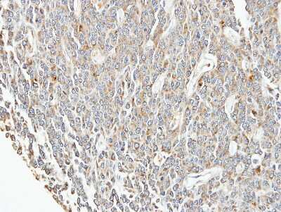 Immunohistochemistry-Paraffin: EIF3F Antibody [NBP2-16299]