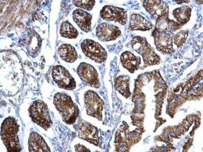 Immunohistochemistry-Paraffin: EIF3F Antibody [NBP2-16299]