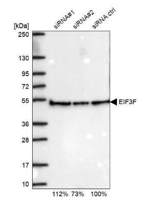 Western Blot: EIF3F Antibody [NBP2-13952]