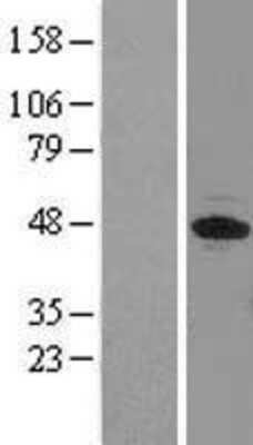 Western Blot: EIF3F Overexpression Lysate [NBL1-10194]