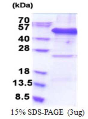 SDS-PAGE: Recombinant Human EIF3F His Protein [NBP2-23030]