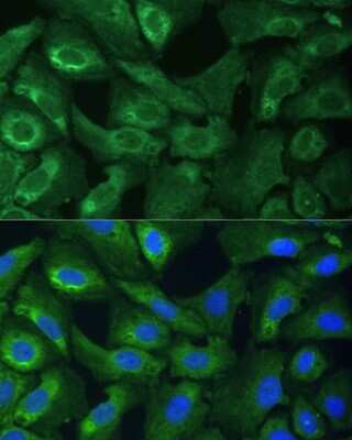 Immunocytochemistry/ Immunofluorescence: EIF3G Antibody - BSA Free [NBP3-04672]