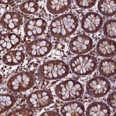 Immunohistochemistry-Paraffin: EIF3G Antibody [NBP1-84872]