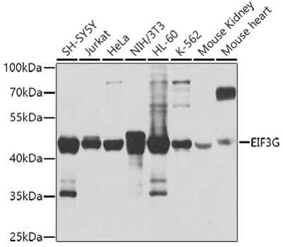 Western Blot: EIF3G AntibodyBSA Free [NBP3-04672]