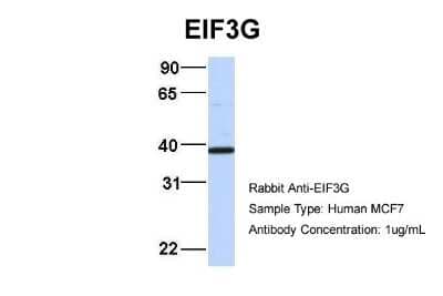 Western Blot: EIF3G Antibody [NBP3-10537]