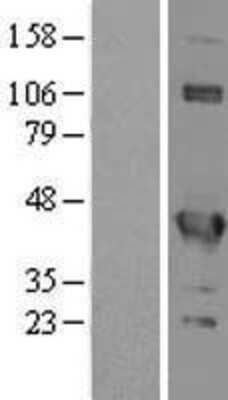 Western Blot: EIF3G Overexpression Lysate [NBL1-10195]