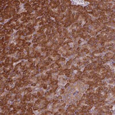 Immunohistochemistry-Paraffin: EIF3J Antibody [NBP2-13953]