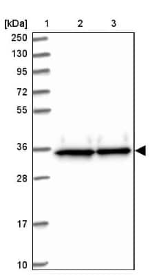 Western Blot: EIF3J Antibody [NBP2-13953]