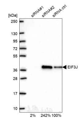 Western Blot: EIF3J Antibody [NBP2-13953]