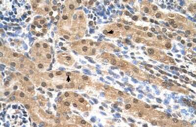 Immunohistochemistry-Paraffin: EIF3M Antibody [NBP1-56654]