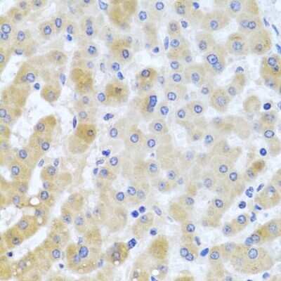 Immunohistochemistry-Paraffin: EIF3M Antibody - BSA Free [NBP3-04704]