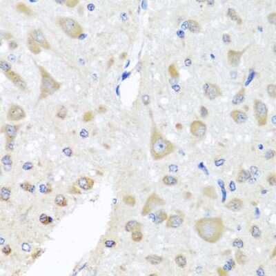 Immunohistochemistry-Paraffin: EIF3M Antibody - BSA Free [NBP3-04704]