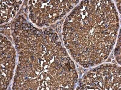Immunohistochemistry-Paraffin: EIF3S3 Antibody (GT35512) [NBP3-13550]