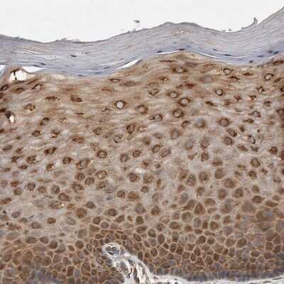 Immunohistochemistry-Paraffin: EIF3S3 Antibody [NBP1-84870]