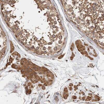 Immunohistochemistry-Paraffin: EIF3S3 Antibody [NBP1-84870]