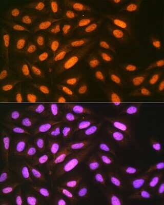 Immunocytochemistry/ Immunofluorescence: EIF4A3 Antibody (6Y3N4) [NBP3-16727]