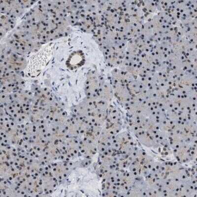 Immunohistochemistry-Paraffin: EIF4A3 Antibody [NBP1-85268]