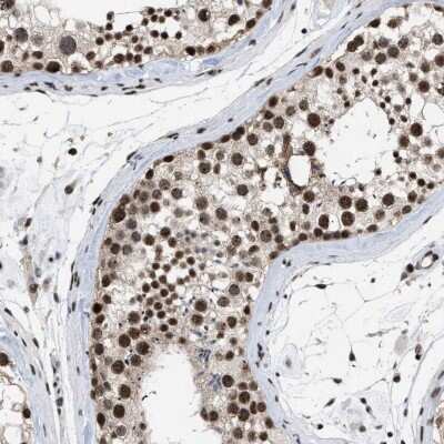 Immunohistochemistry-Paraffin: EIF4A3 Antibody [NBP1-85268]