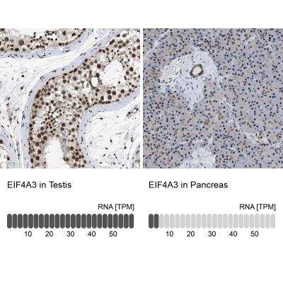 Immunohistochemistry-Paraffin: EIF4A3 Antibody [NBP1-85268]