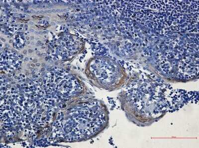 Immunohistochemistry-Paraffin: EIF4A3 Antibody (S05-1B7) [NBP3-14928]