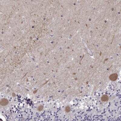 Immunohistochemistry-Paraffin: EIF4E1B Antibody [NBP2-14543]