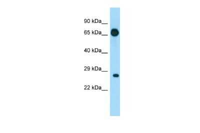 Western Blot: EIF4E1B Antibody [NBP2-82985]